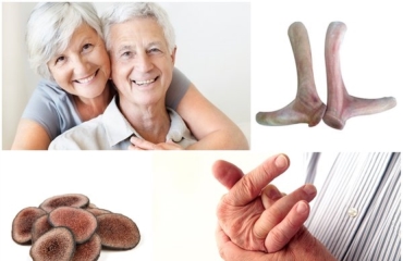 NỖI LO XƯƠNG KHỚP Ở NGƯỜI LỚN TUỔI